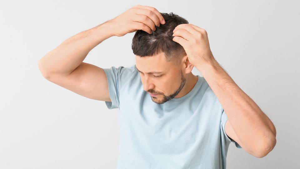 hair loss